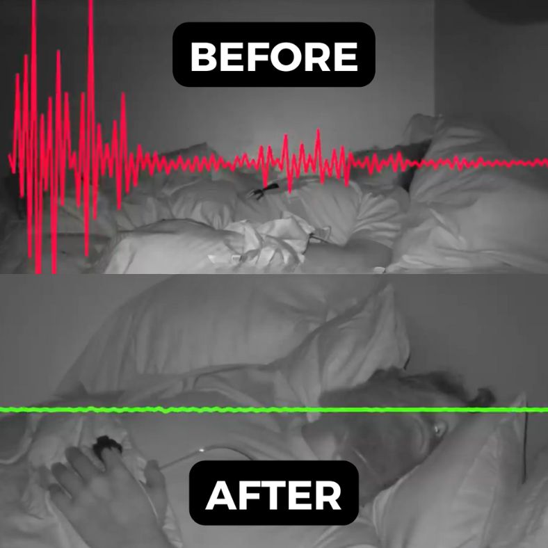 ReliefStrap™ Comforted Jaw Relief