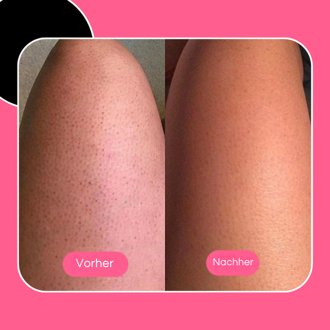 ExfoPuff™ Smooth Glowing Skin