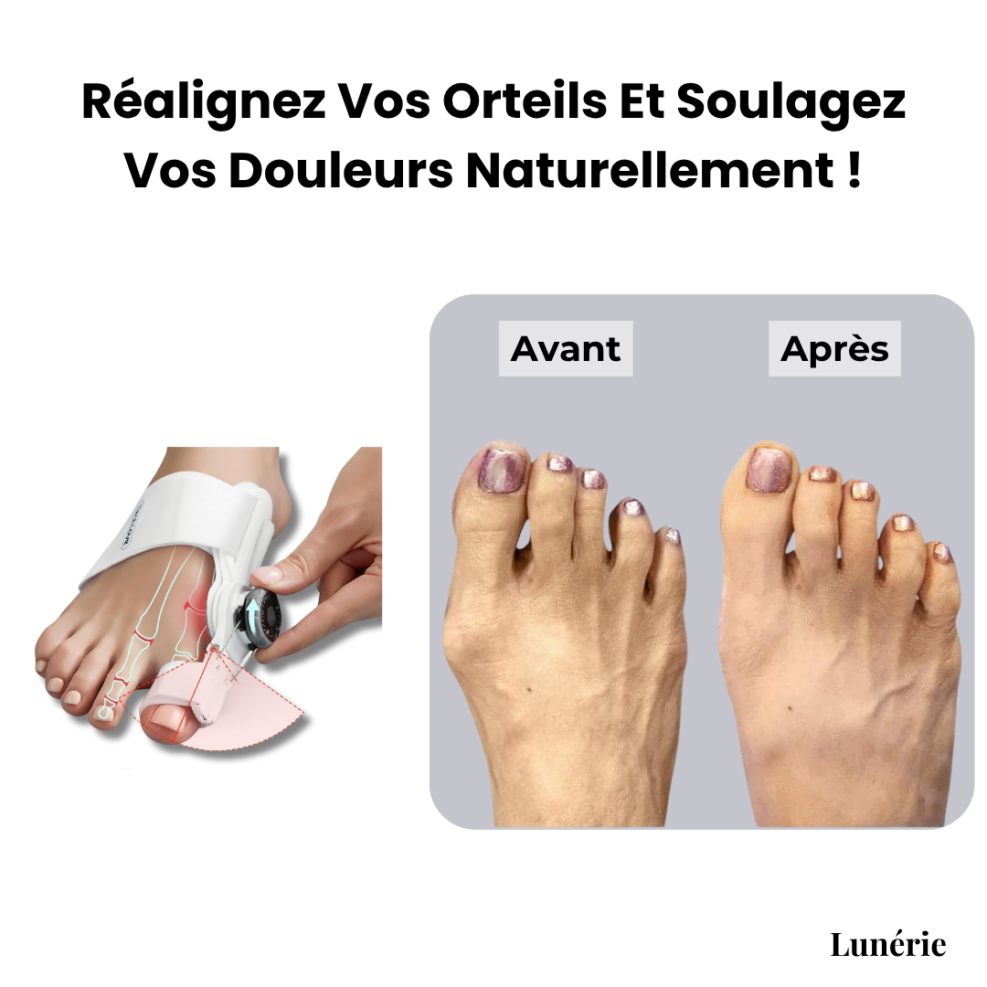 ToeAlign™ Restore Natural Alignment