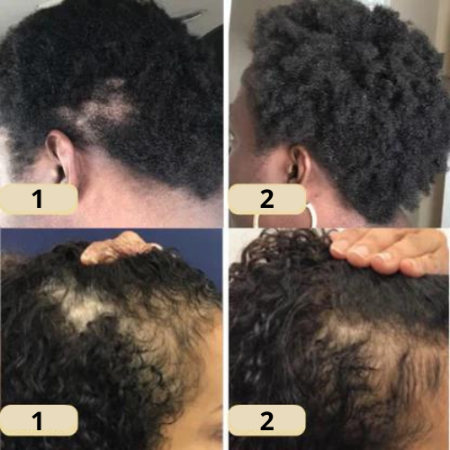VitalGrowth™ Hair Growth Oil