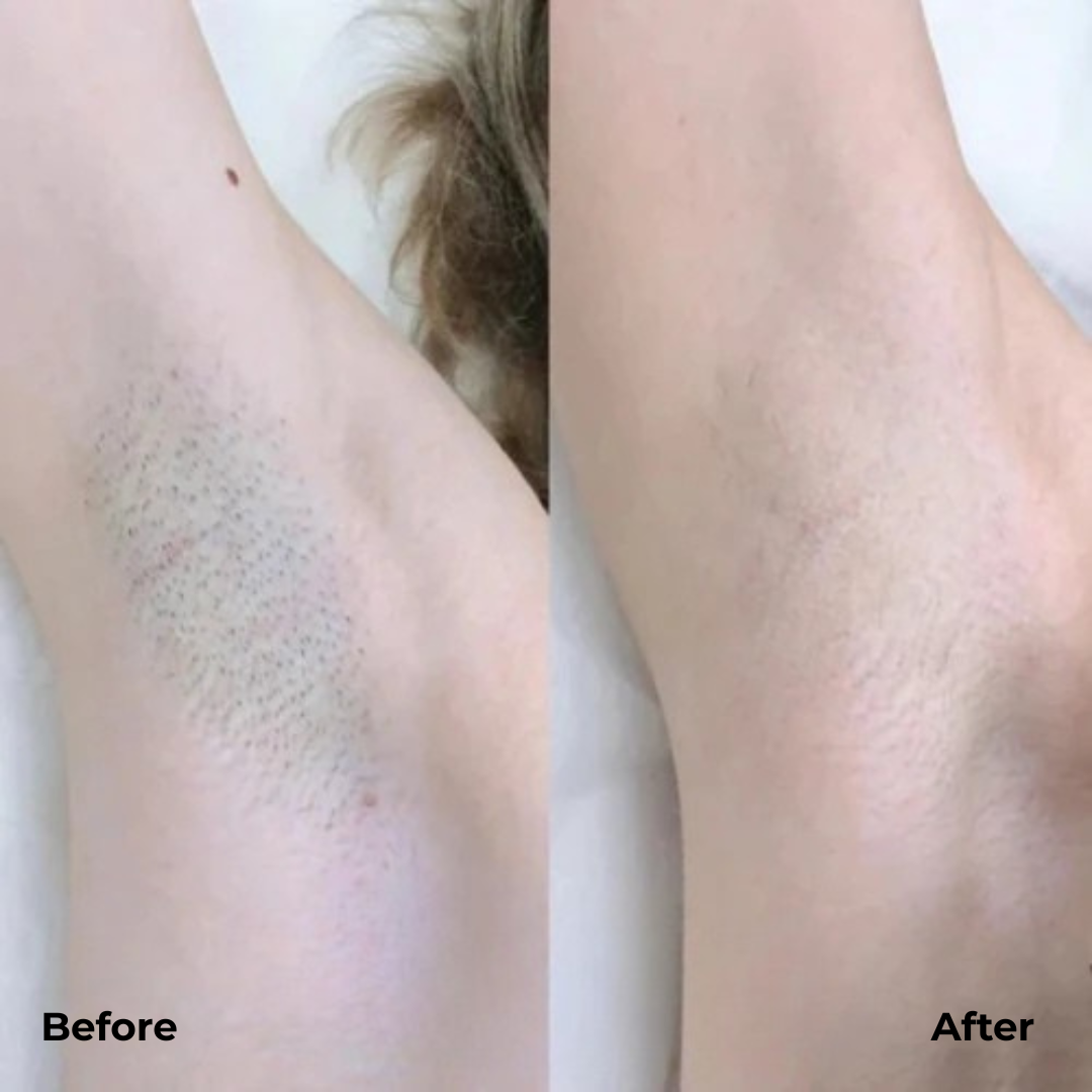 DualTrim™ Precision Shave Comfort