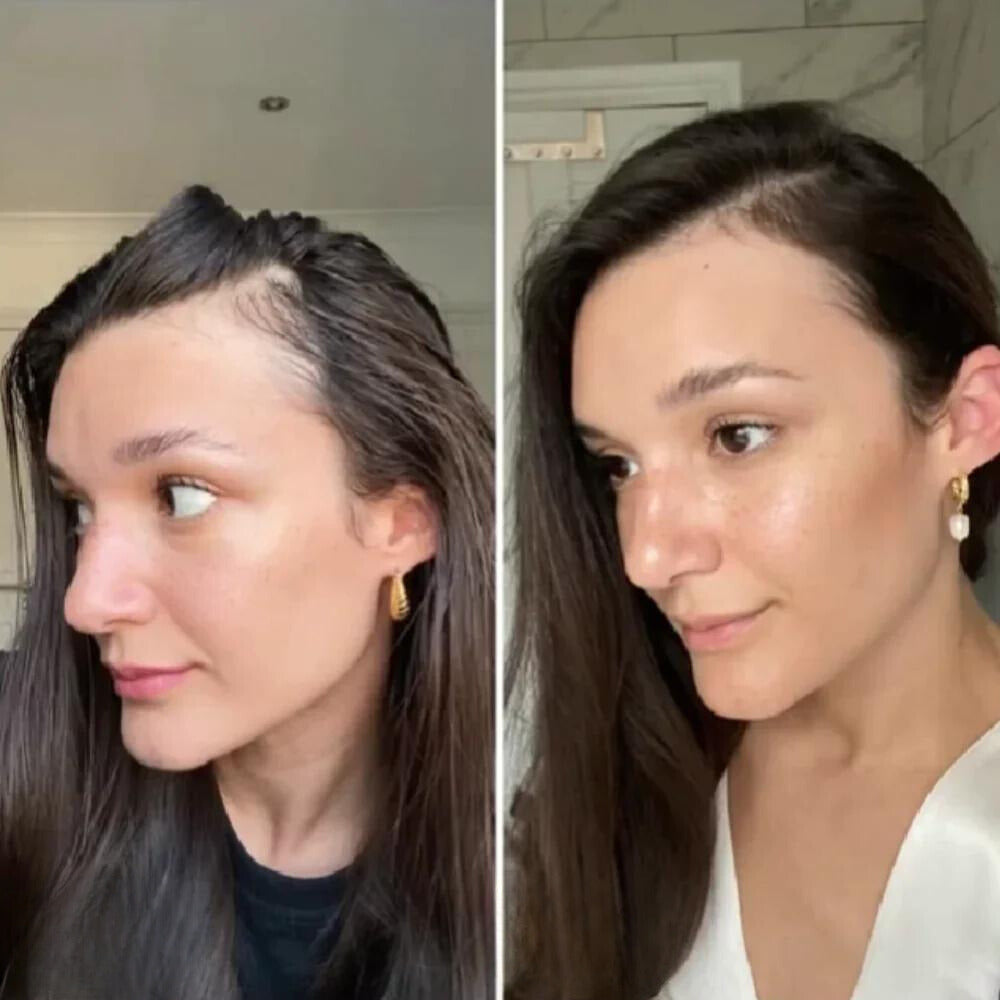 VitalGrowth™ Hair Growth Oil