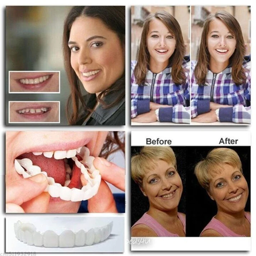 InstaDent™ Reusable Smile Solution