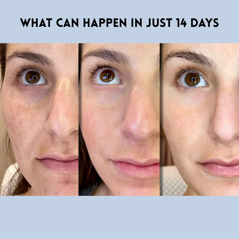 FirmPatch™ Wrinkle-Free Confidence