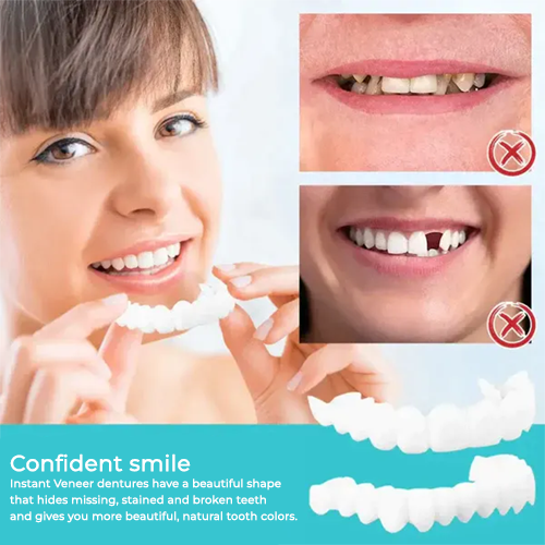 InstaDent™ Reusable Smile Solution