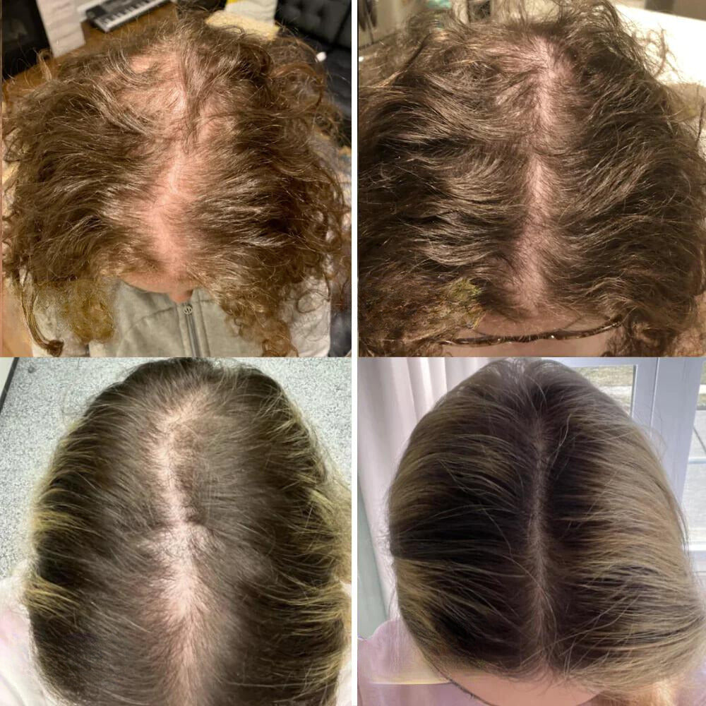 VitalGrowth™ Hair Growth Oil