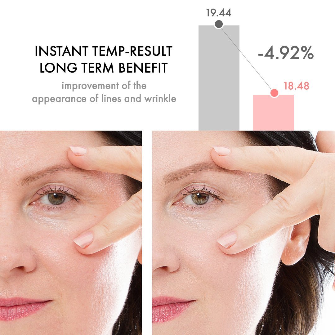 WrinkleAway™ Reduces Fine Lines