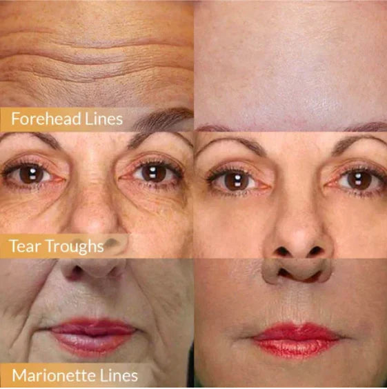 FaceLuxe™ Ageless Confidence Cream