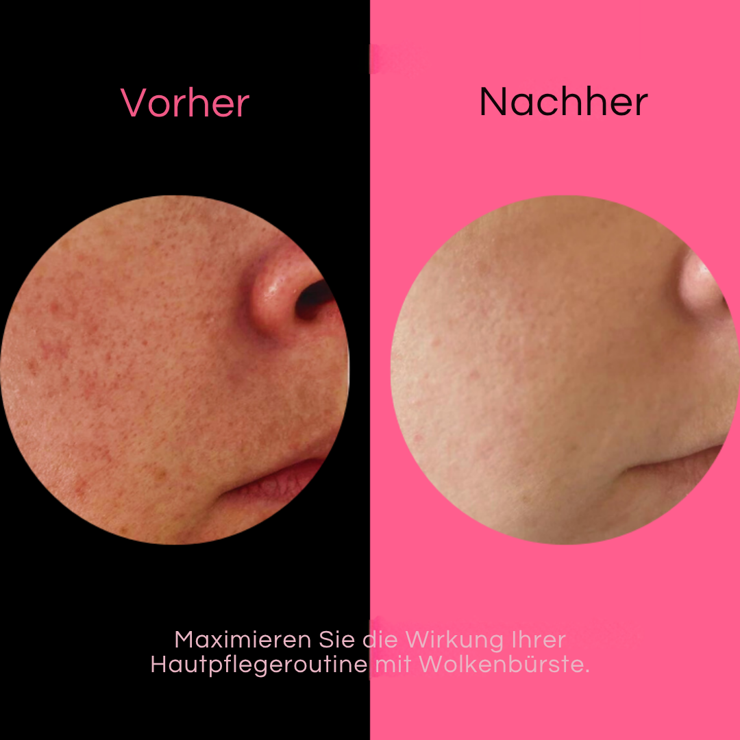 ExfoPuff™ Smooth Glowing Skin