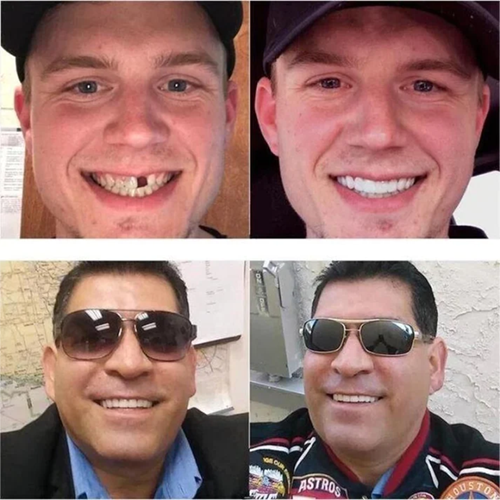 InstaDent™ Reusable Smile Solution