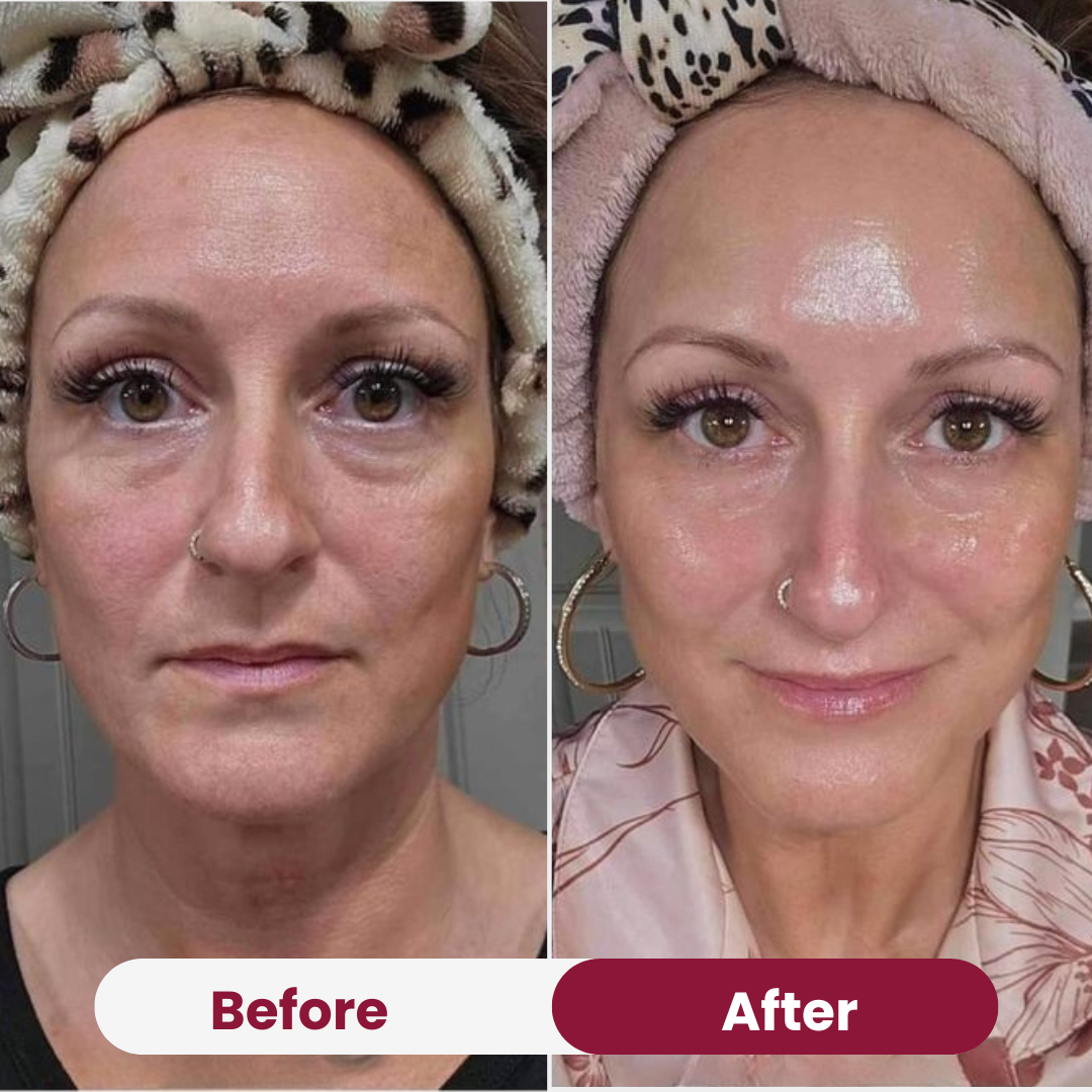 CollagenGlow™ Firming Renewal Complex