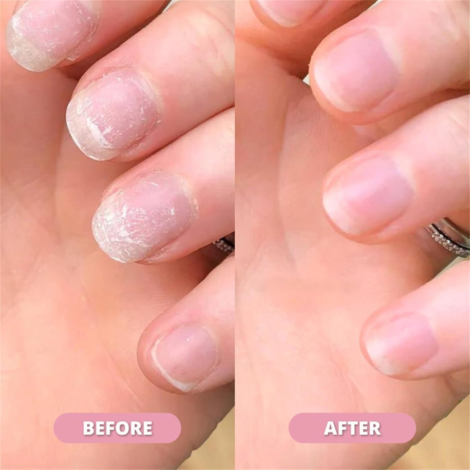 VitalNails™ Revive Damaged Nails