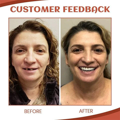 ComfortLock™ Flexible Secure Fit