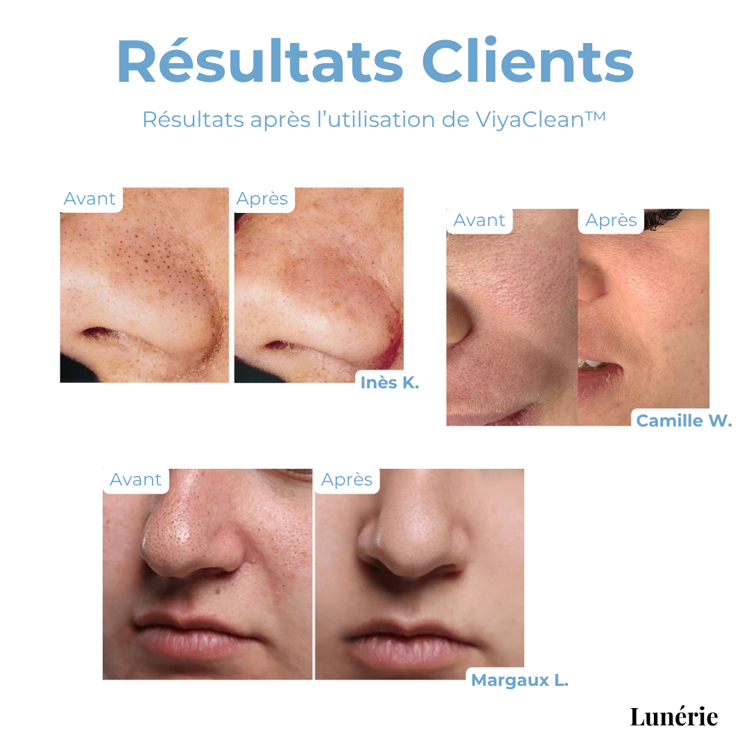 SkinClear™ Skin Renewal Therapy