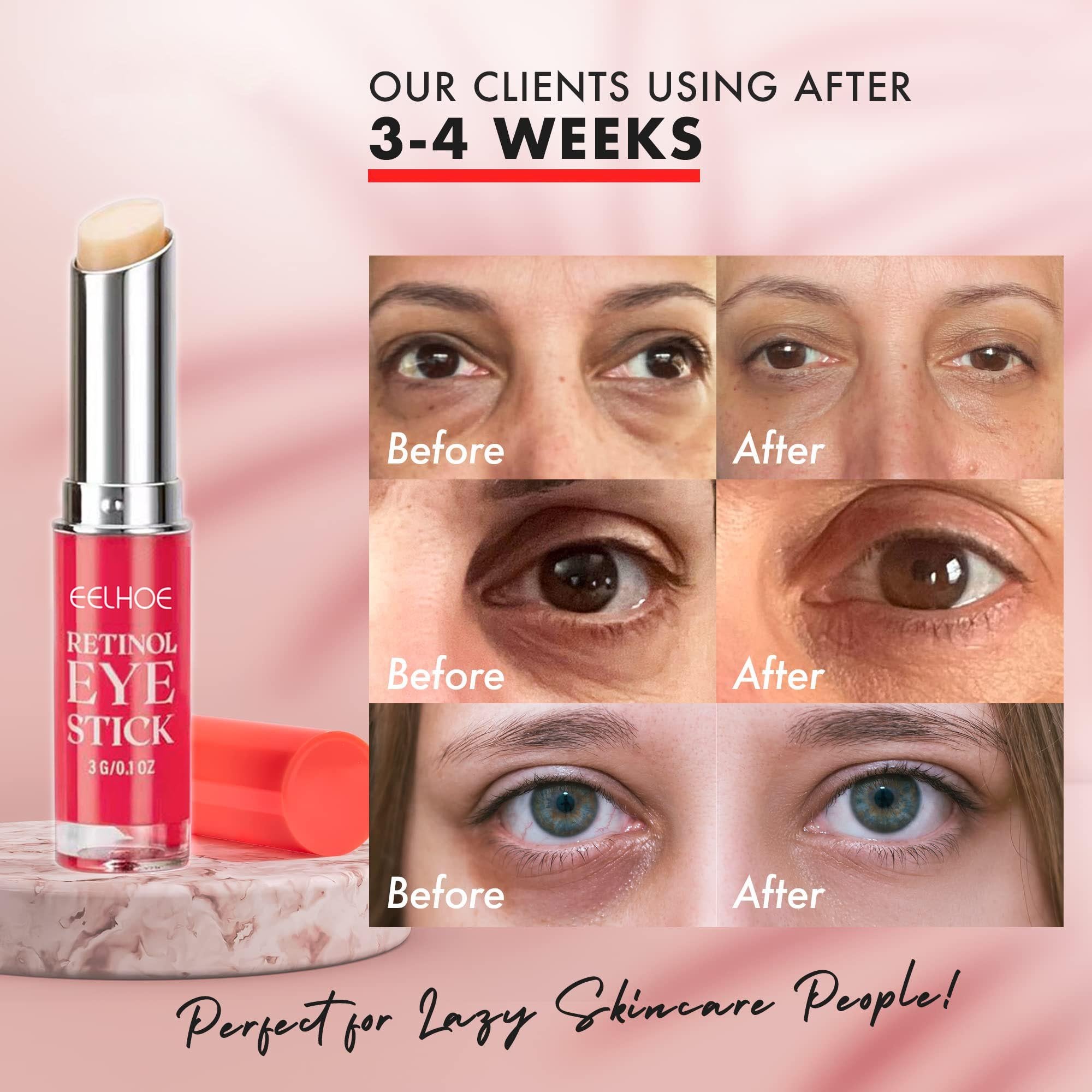 WrinkleAway™ Reduces Fine Lines