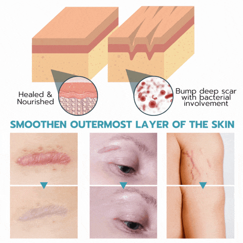 2+2 Free | SmoothPatch™ Wrinkle-Free Confidence