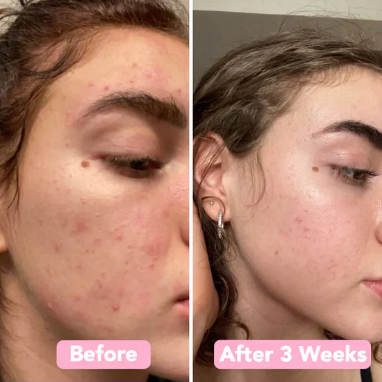 2+2 Free | BrightEase™ Gentle Bright Glow