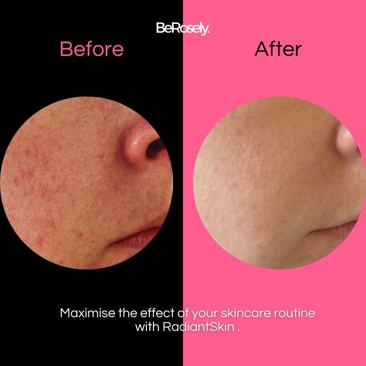 GlowScrub™ Gentle Daily Exfoliation