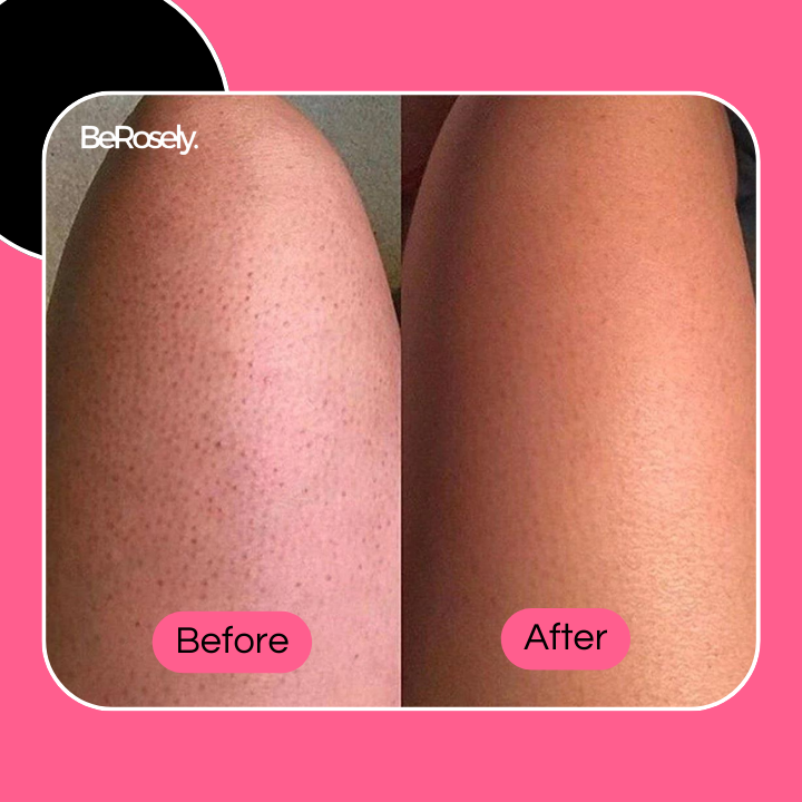 GlowScrub™ Gentle Daily Exfoliation