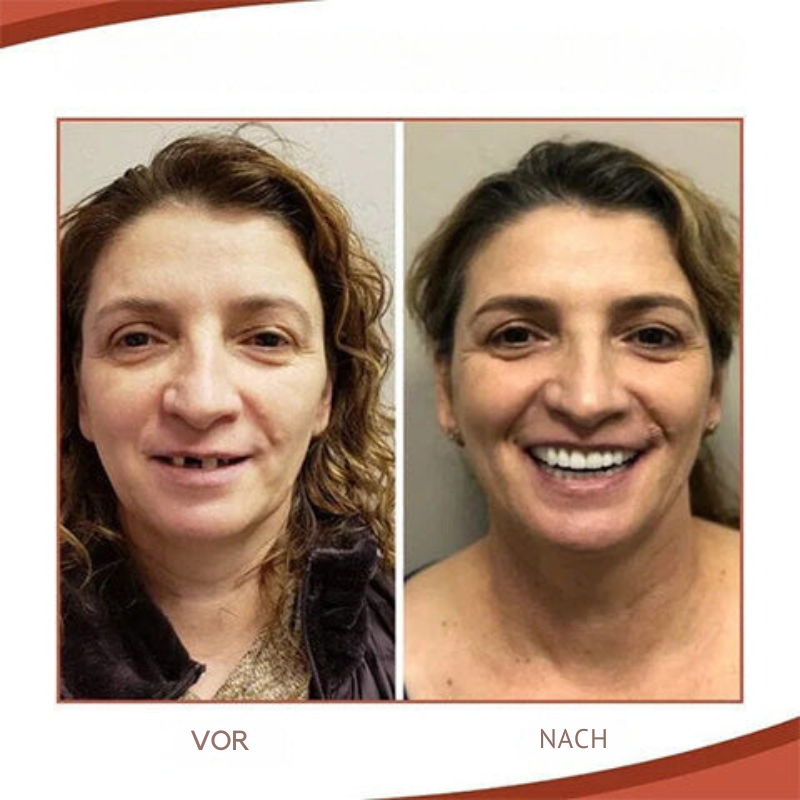 SilicareKit™ Cushions Denture Pressure