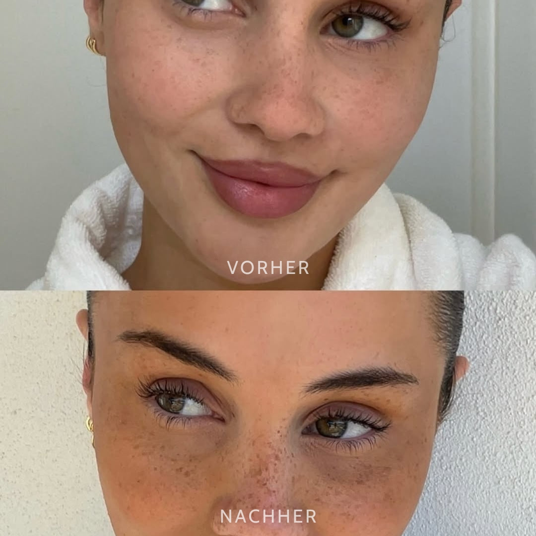 SpeckleTouch™ Playful Beauty Accent