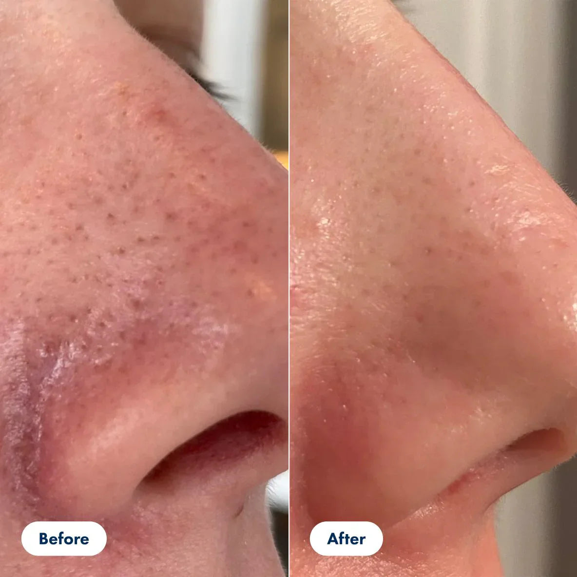 GrainGlow™ Bright Even Complexion