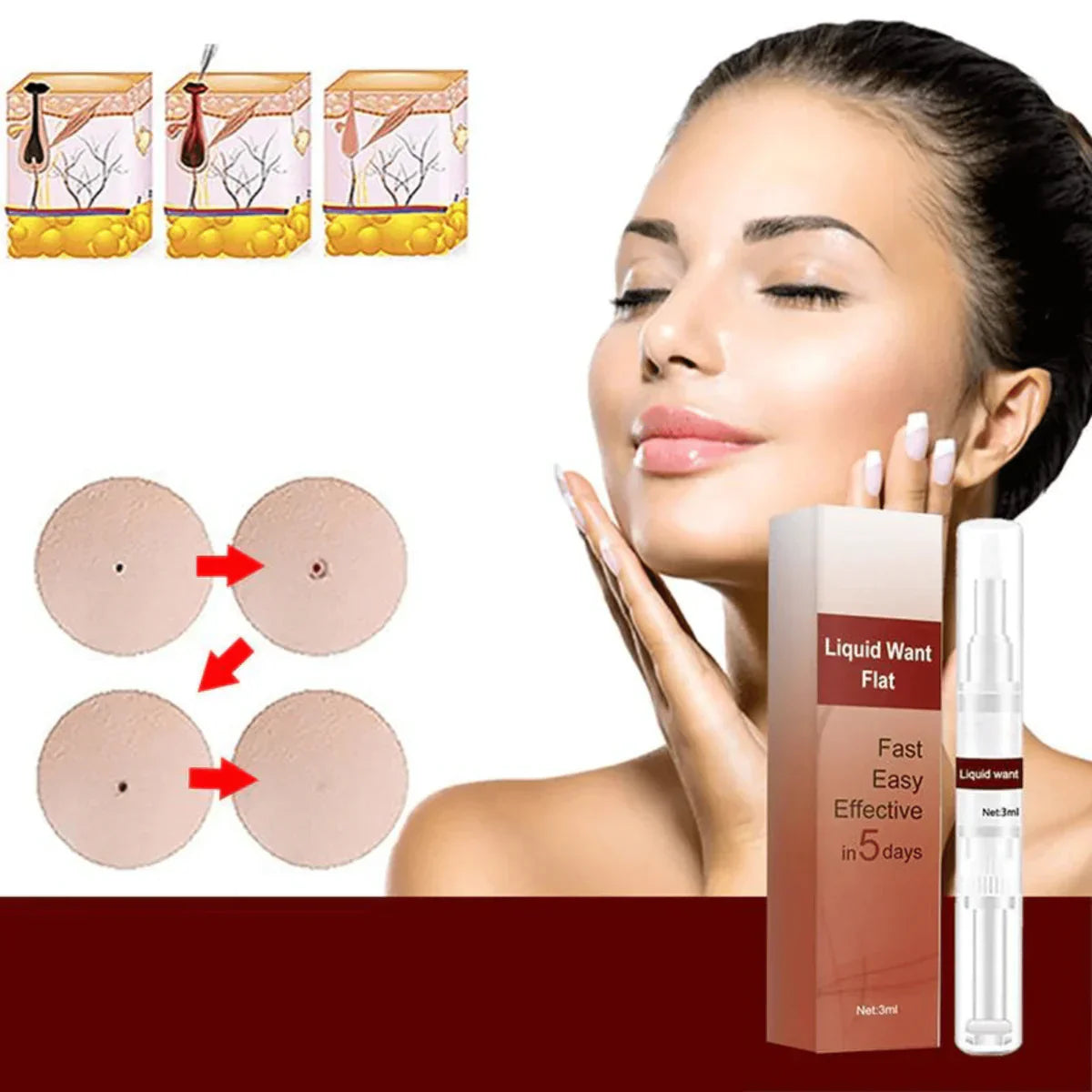 1+1 Free | MoleAway™ Painless Tag Removal