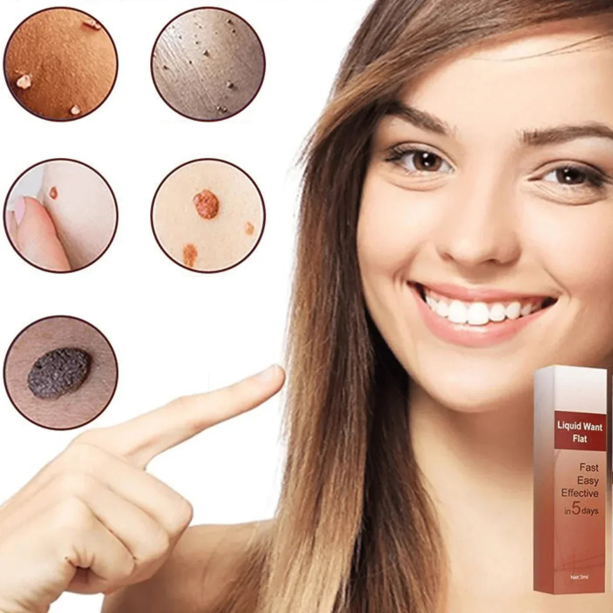 1+1 Free | MoleAway™ Painless Tag Removal