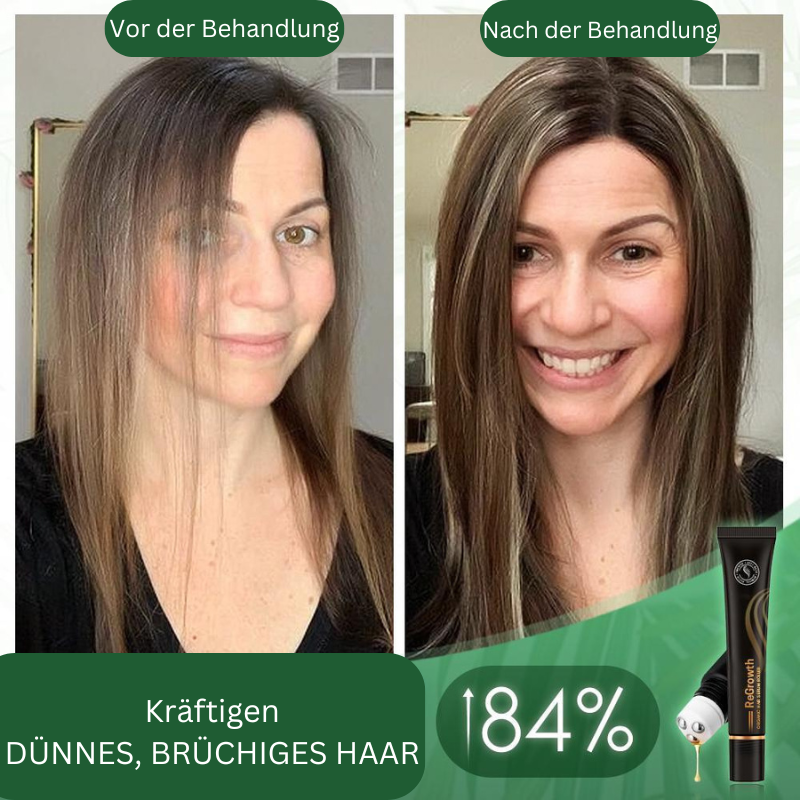 1+1 Free | GrowthRoller™ Stimulates Hair Growth