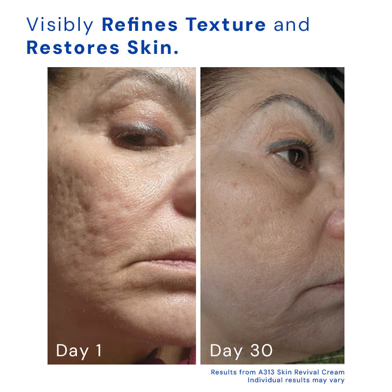 AgeDefy™ Smooth Wrinkle Repair