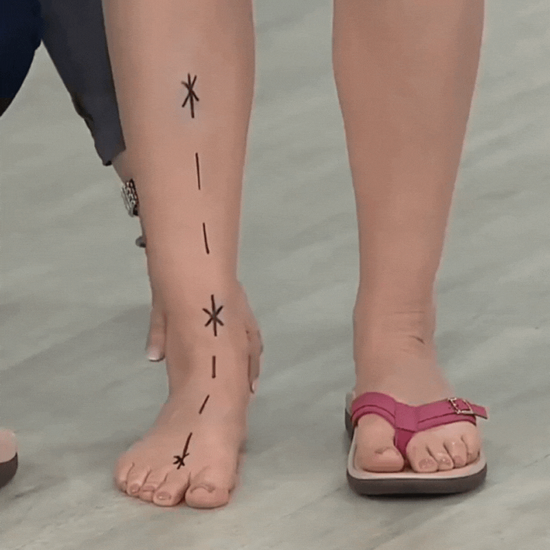 Lorelei™ Orthopedic Summer Sandals