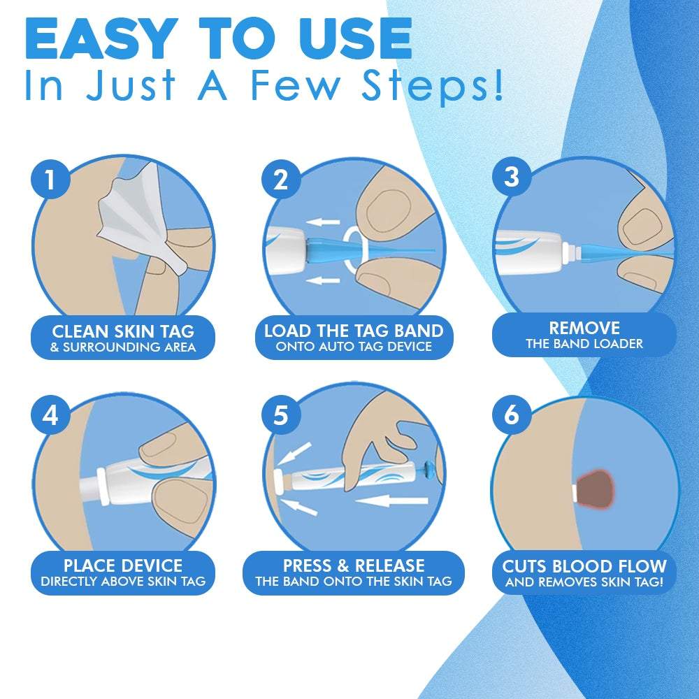 WartAway™ Targets Skin Growths