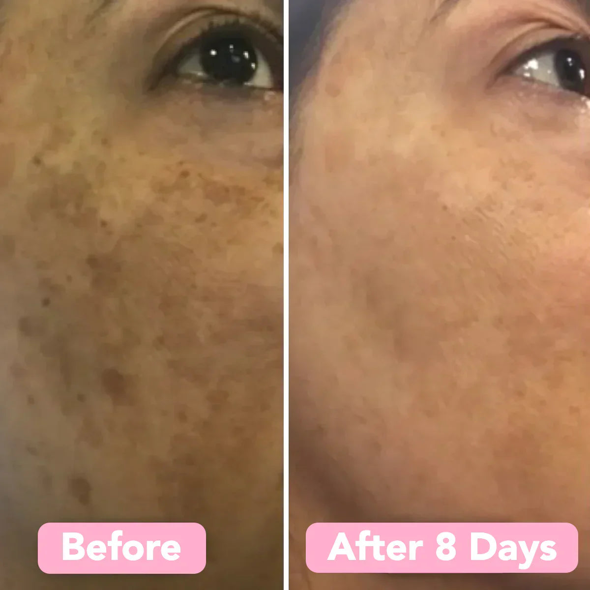 2+2 Free | BrightEase™ Gentle Bright Glow