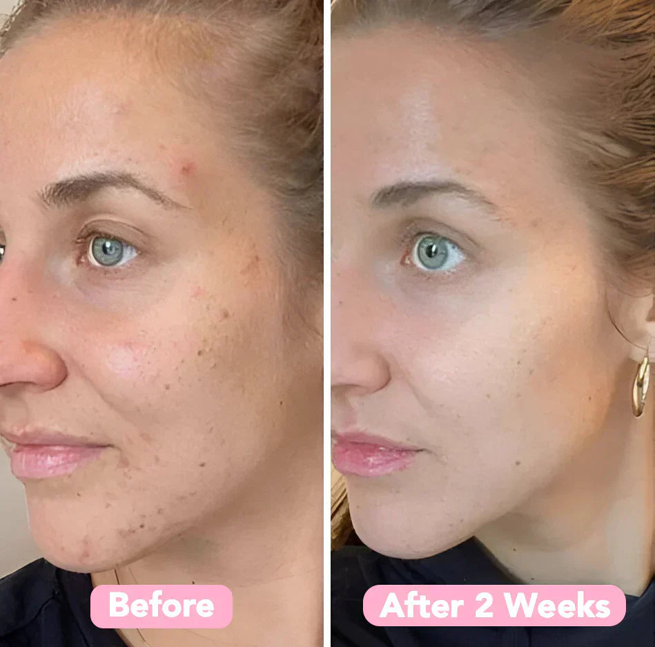 GlowPurify™ Radiance Renewal Cleanse