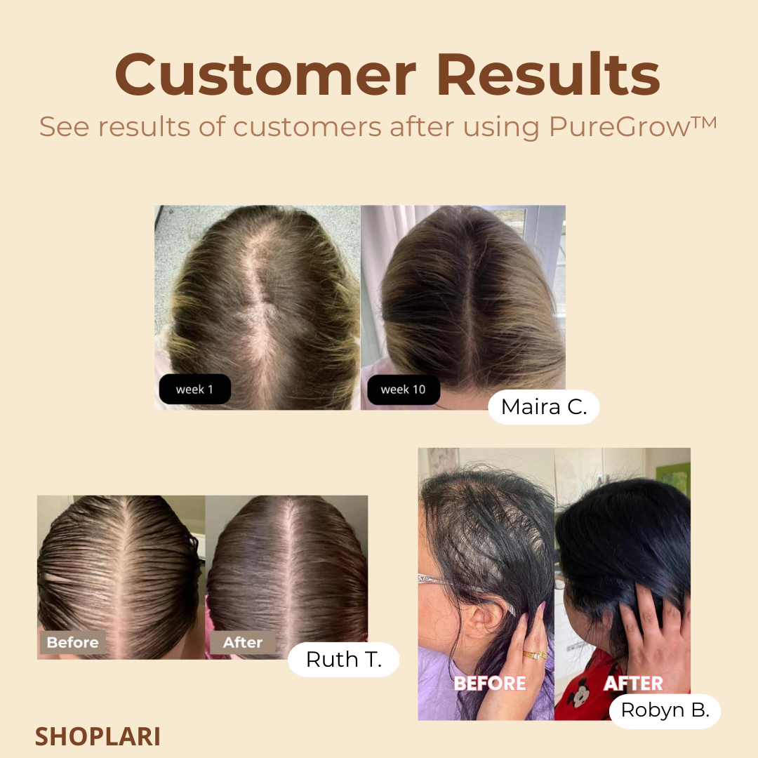 BatanaSilk™ Deep Scalp Nourishment