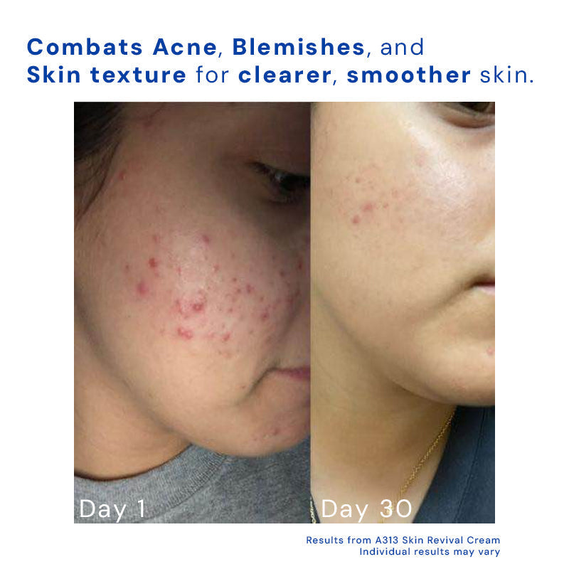 AgeDefy™ Smooth Wrinkle Repair