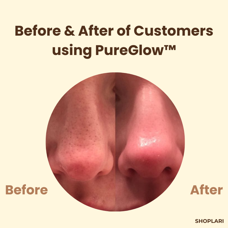 1+1 Free | PureSkin™ Complexion Repair Solution