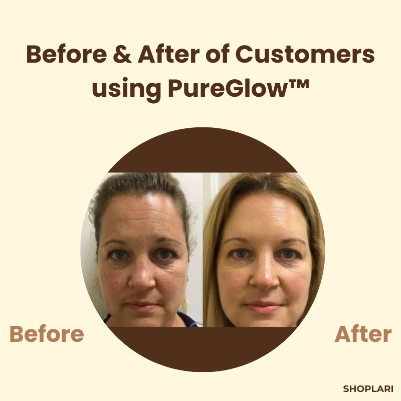 1+1 Free | PureSkin™ Complexion Repair Solution