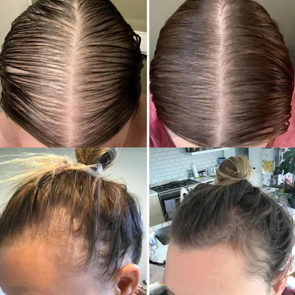 VitalGrowth™ Hair Growth Oil