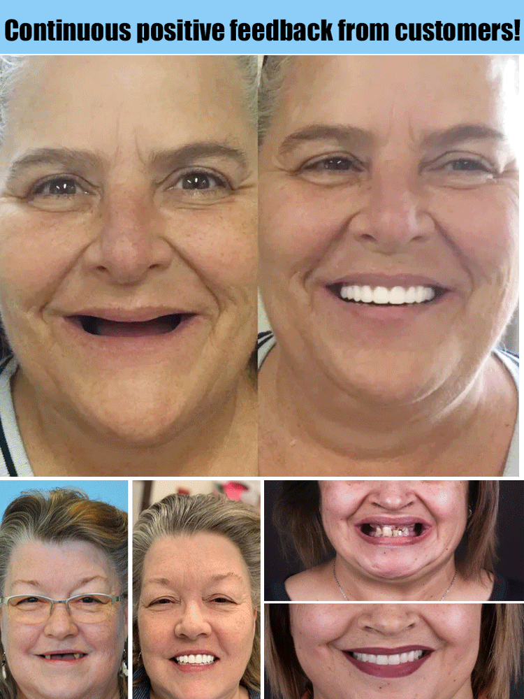 PureDent™ Ultimate Smile Restoration