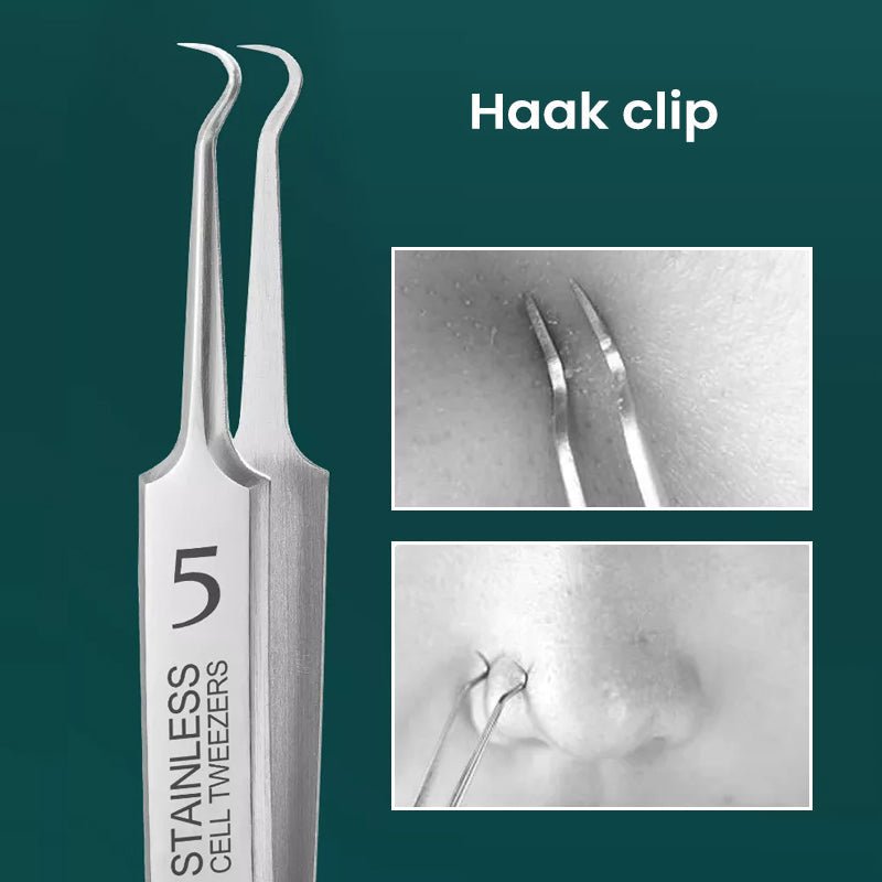 TweezeClear™ Targeted Blemish Extraction