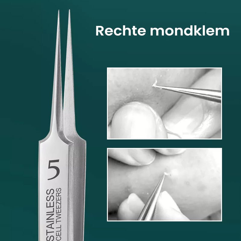 TweezeClear™ Targeted Blemish Extraction