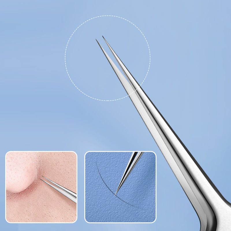TweezeClear™ Targeted Blemish Extraction