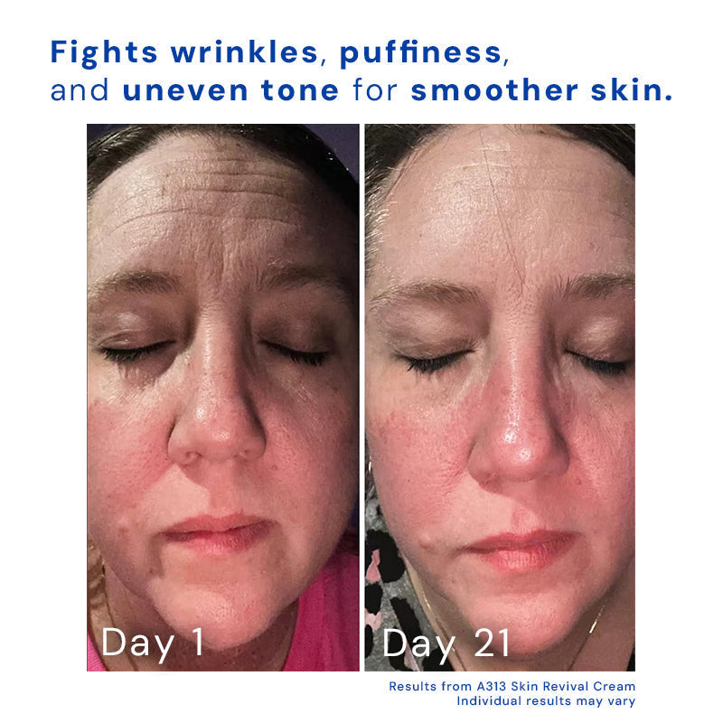 AgeDefy™ Smooth Wrinkle Repair