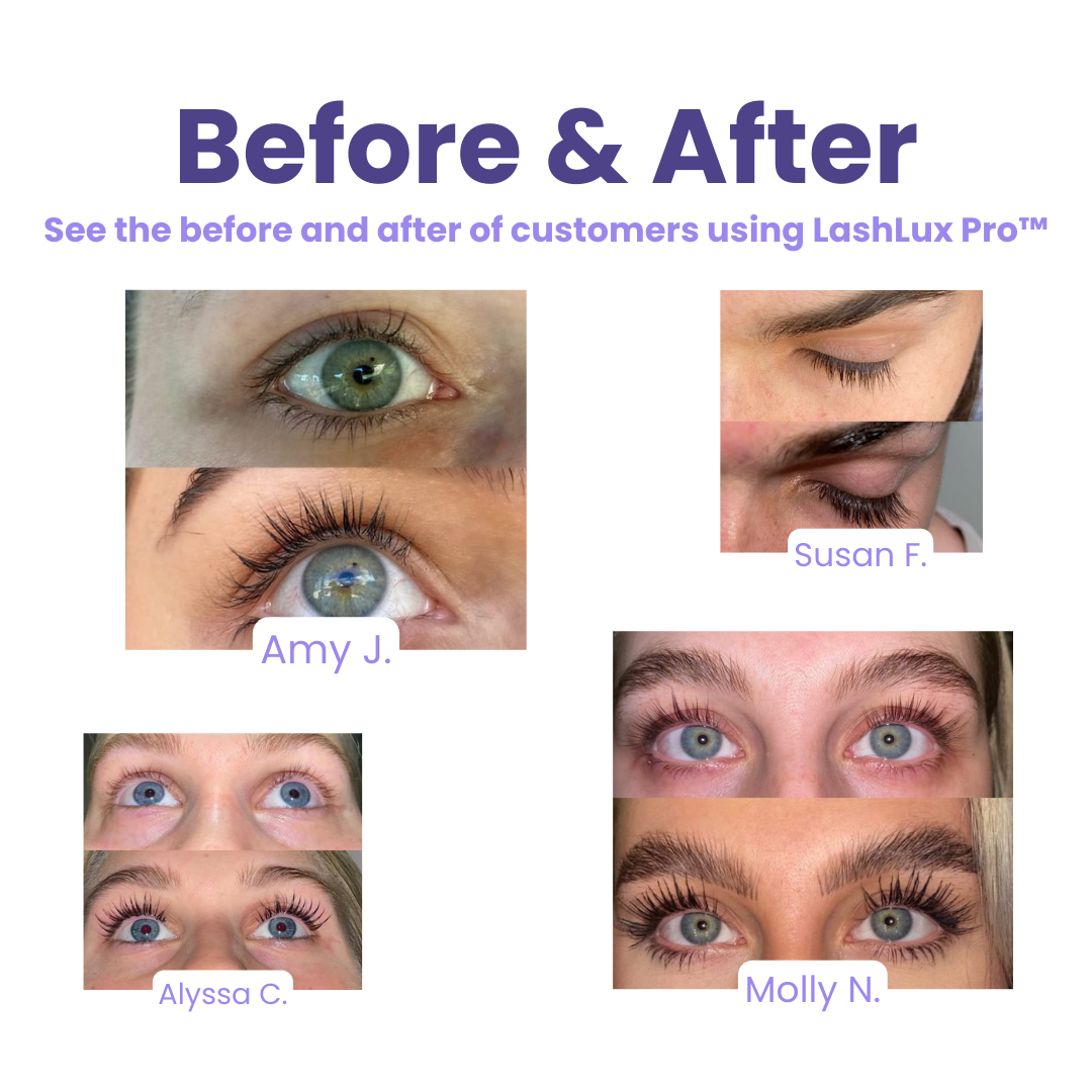 1+1 Free | LashForte™ Dramatic Lash Transformation