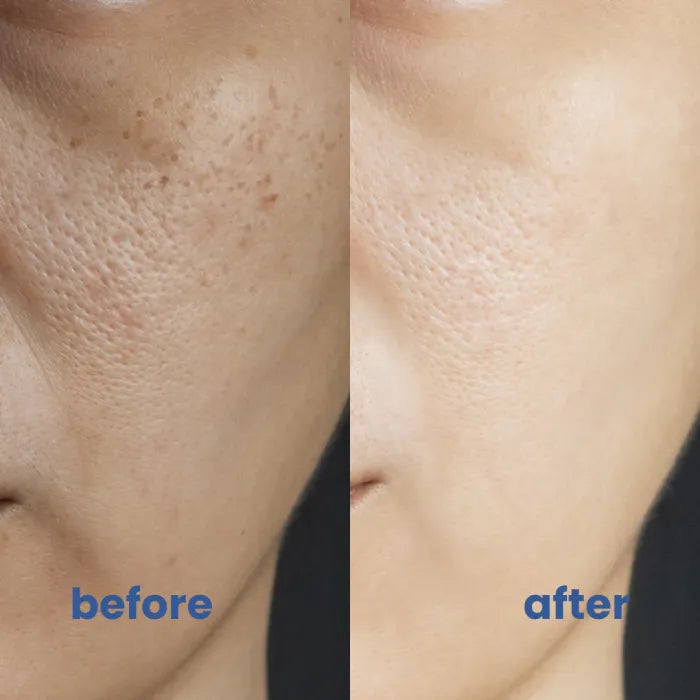 GlowCorrector™ Evens Skin Tone