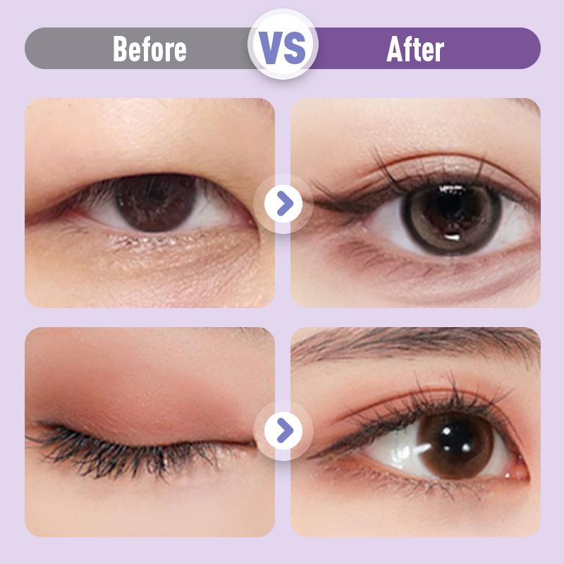 LidLift™ Youthful Eye Definition